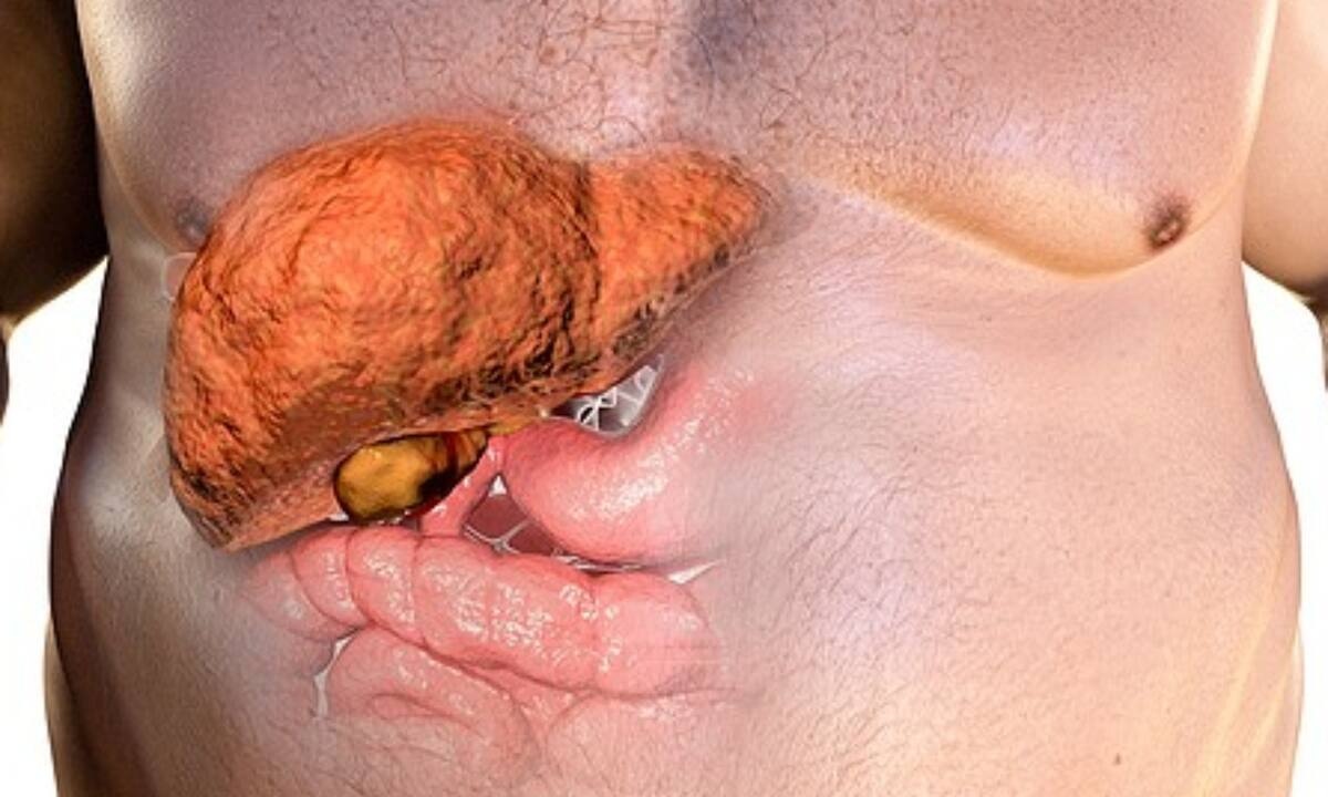 Λιπώδες ήπαρ: 7 προειδοποιητικά συμπτώματα (video)