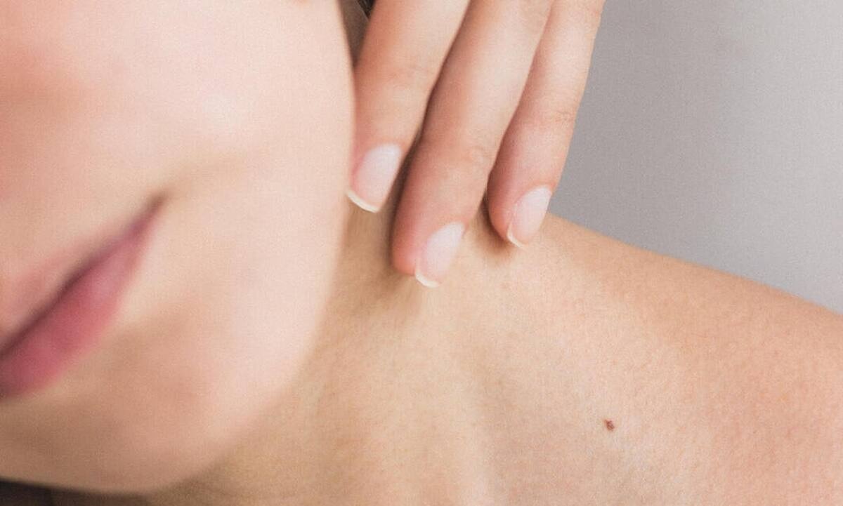 Οι διεσταλμένοι πόροι δεν είναι αφύσικοι, είναι μέρος της επιδερμίδας μου και τους αγαπώ