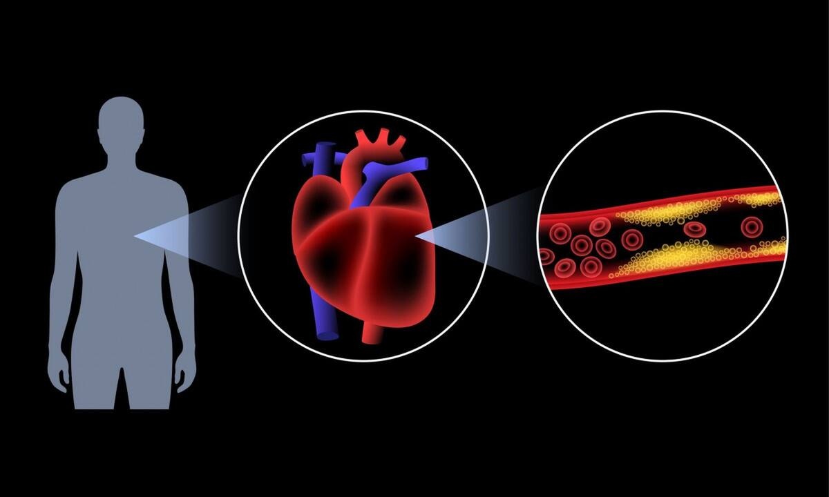 Πρόβλημα στις αρτηρίες: Προσοχή σε αυτά τα παράδοξα σημάδια (εικόνες)