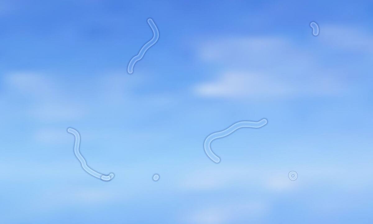 Βλέπετε «μυγάκια»; Τι είναι και πώς μπορούν να επηρεάσουν την όρασή σας (video)