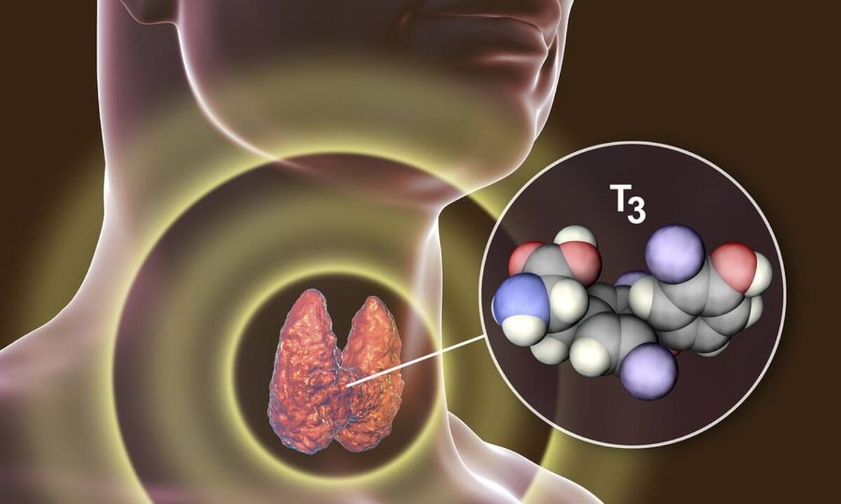 Θυρεοειδίτιδα Χασιμότο: Με ποια συμπτώματα εκδηλώνεται (εικόνες)