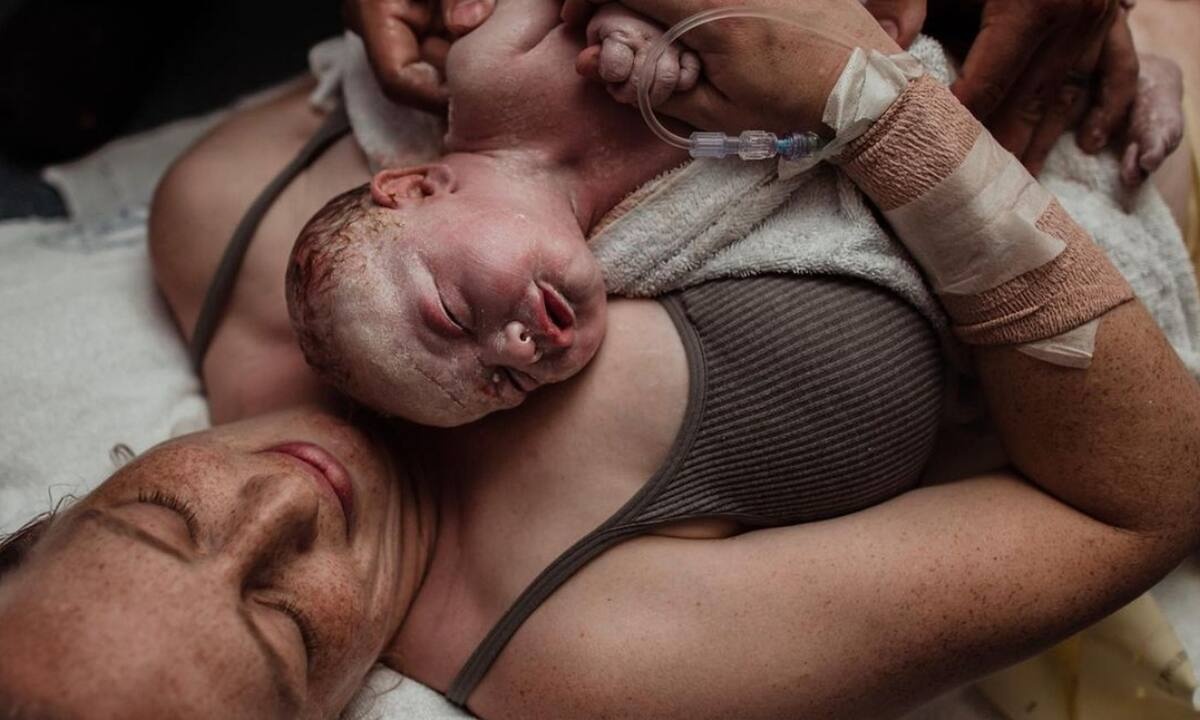 Δέκα φωτογραφίες τοκετού από μία βραβευμένη φωτογράφο (εικόνες)