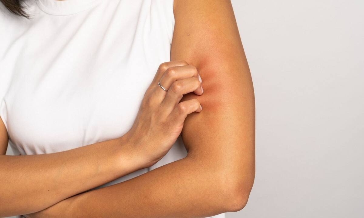 Φαγούρα χωρίς εξανθήματα: Οι πιθανές αιτίες (εικόνες)