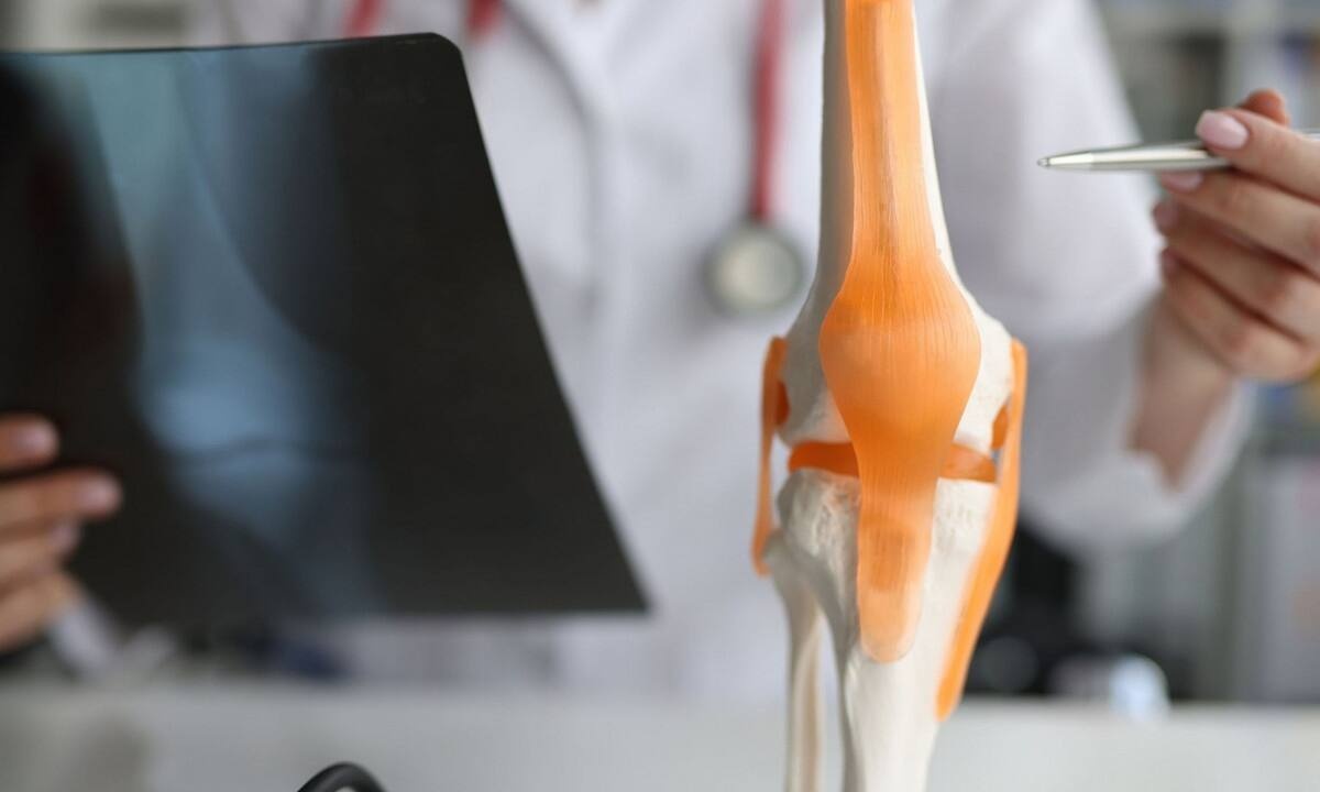 Τα 4 απαραίτητα θρεπτικά συστατικά για γερά οστά (εικόνες)