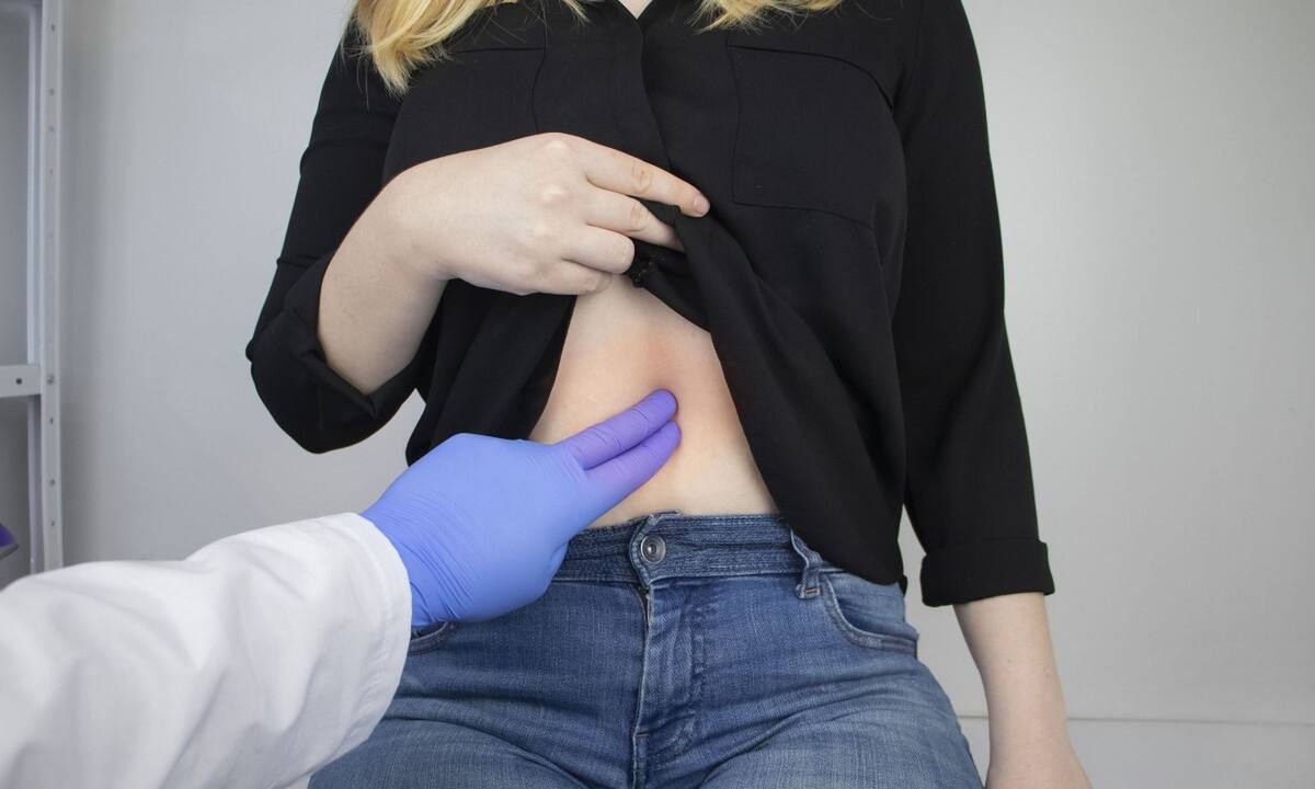 Πεπτικό έλκος: Ποια είναι τα βασικά συμπτώματα (εικόνες)