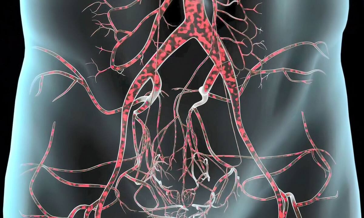 Ανεύρυσμα αορτής: Τα συμπτώματα που πρέπει να γνωρίζετε (εικόνες)