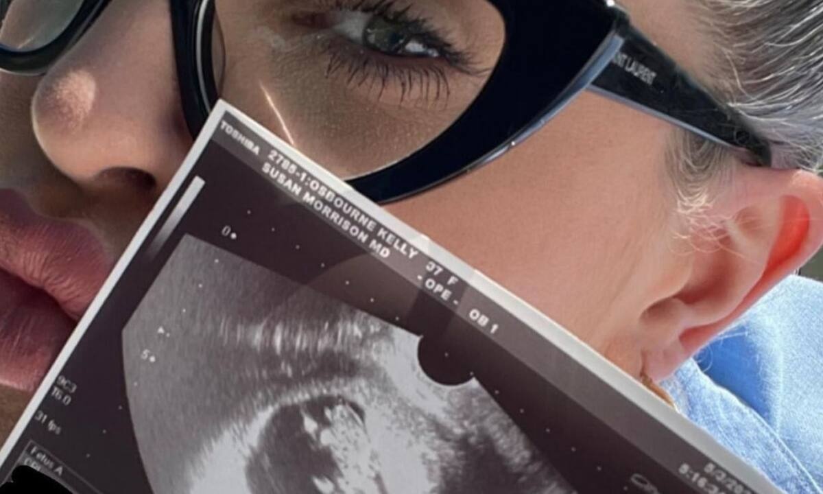 Η ντίβα του Hollywood περιμένει το πρώτο της παιδί και ποζάρει με τον υπέρηχο