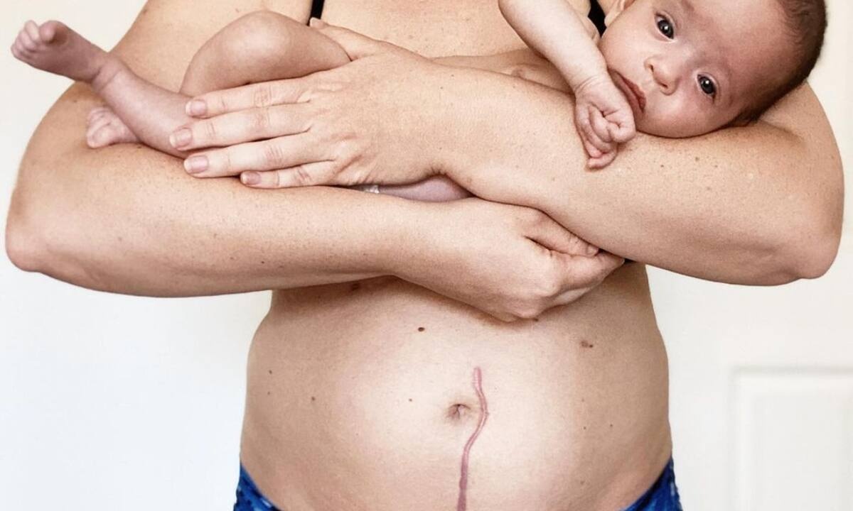 «Το δέρμα μας κουβαλάει τον πόνο και τις εμπειρίες μας»