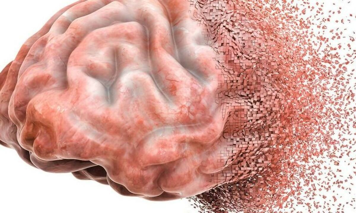 Πώς ο ανθρώπινος εγκέφαλος επεξεργάζεται και αποθηκεύει την κίνηση - μελέτη