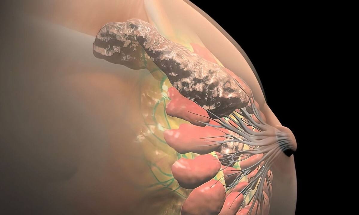 Ο καρκίνος εξαπλώνεται ταχύτερα ενώ κοιμόμαστε - Τι δείχνει νέα έρευνα