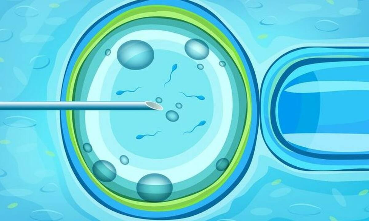 Τα παιδιά που συλλαμβάνονται μέσω εξωσωματικής γονιμοποίησης δεν αναπτύσσονται διαφορετικά - μελέτη