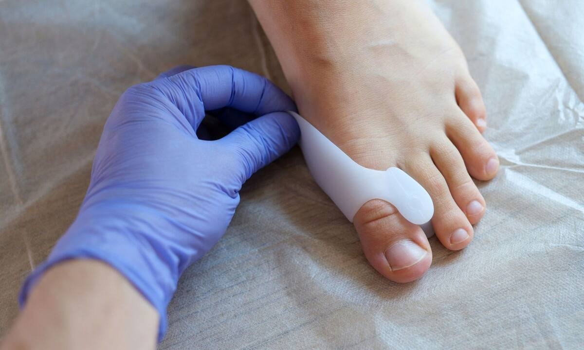 Κότσι: Οι αιτίες που το προκαλούν & οι θεραπευτικές επιλογές