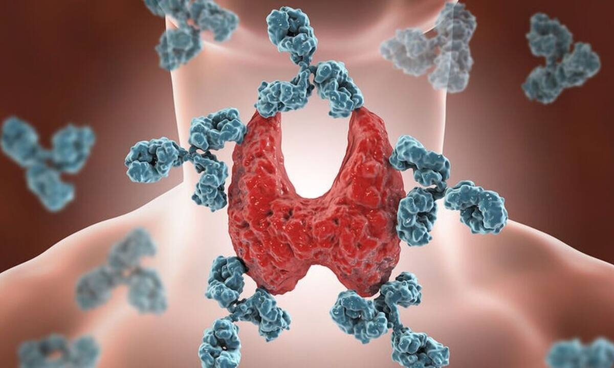 Καρκίνος θυρεοειδούς: Ο ρόλος της κεντρικής παχυσαρκίας