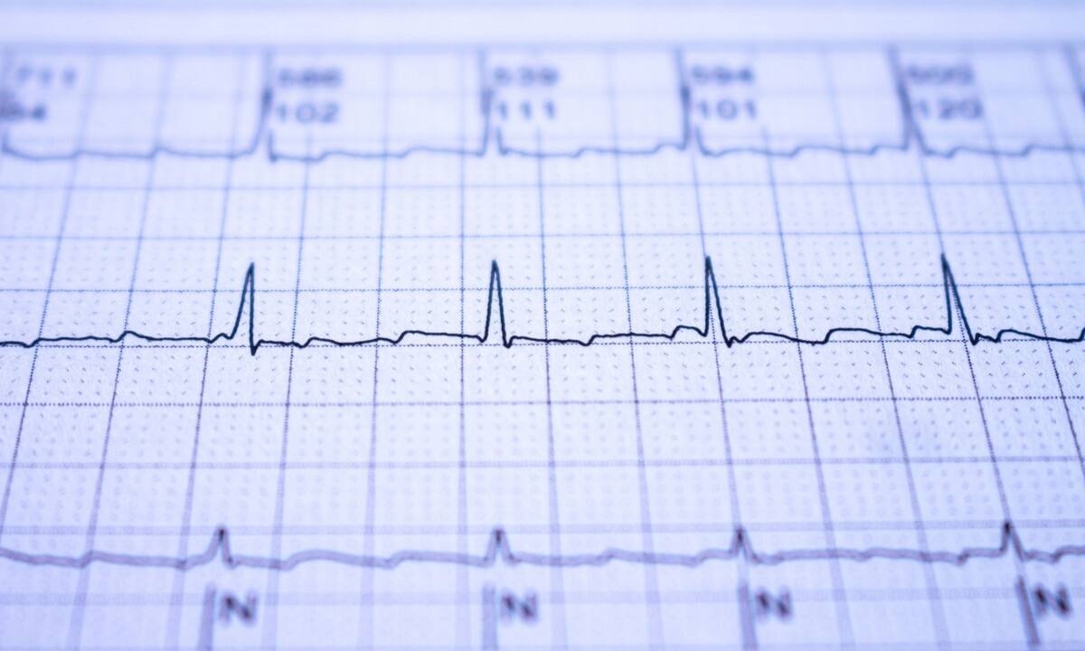 Υψηλό ουρικό: Πόσο αυξάνει τον κίνδυνο κολπικής μαρμαρυγής