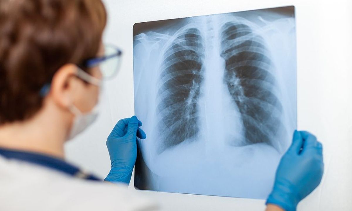 Γήρανση πνευμόνων: Οι βασικοί παράγοντες κινδύνου