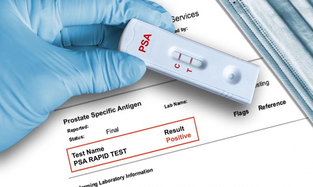 Υγεία προστάτη: Πόσο ωφελεί ο τακτικός έλεγχος του PSA;