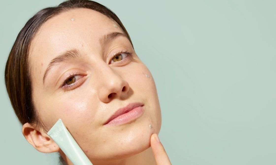 Oh yes! Υπάρχει ένα προϊόν που μπορεί να εξαφανίσει τα σπυράκια σου σε μόλις 1 ώρα