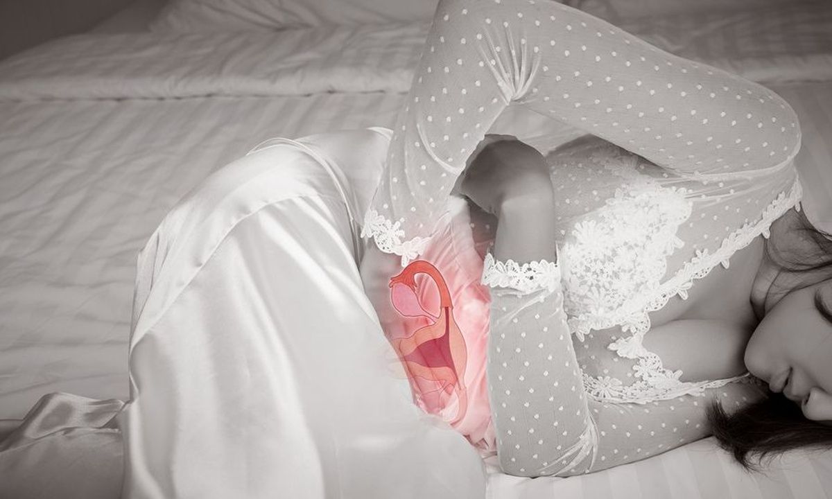 Καρκίνος ενδομητρίου: Οι 5 κυριότεροι παράγοντες κινδύνου