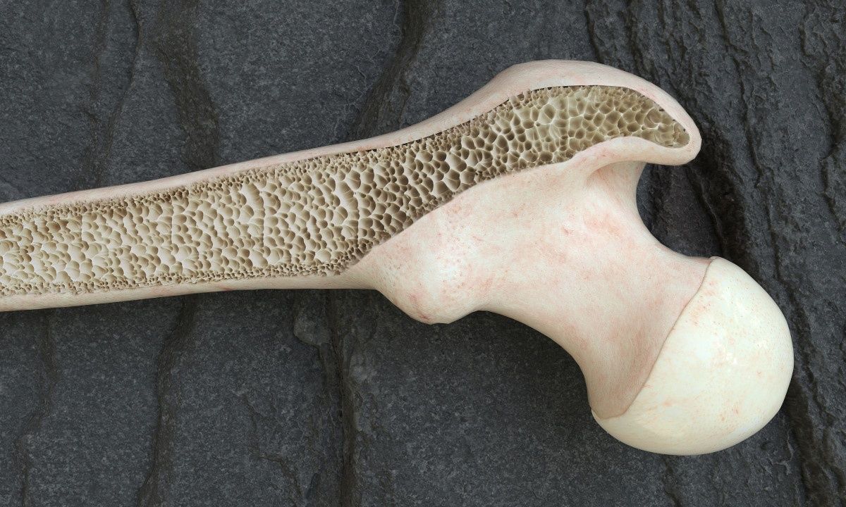 Οστεοπενία και οστεοπόρωση: Πώς θα αποφύγετε ένα πιθανό κάταγμα