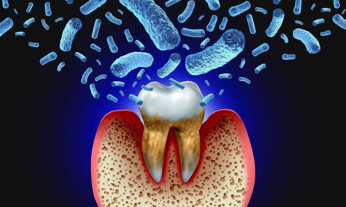 Παχυσαρκία και καρκίνος του στόματος: Πώς συνδέονται