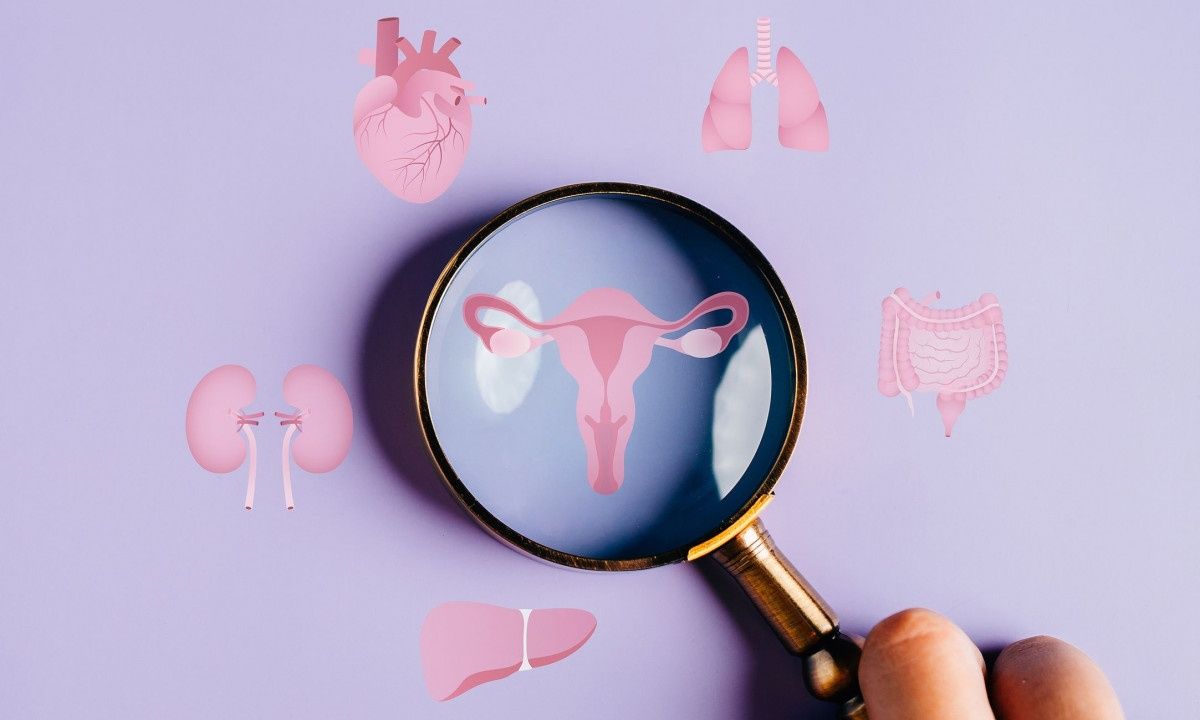 Καρκίνος ωοθηκών: Ο συνδυασμός φαρμάκων που συρρικνώνει τους όγκους