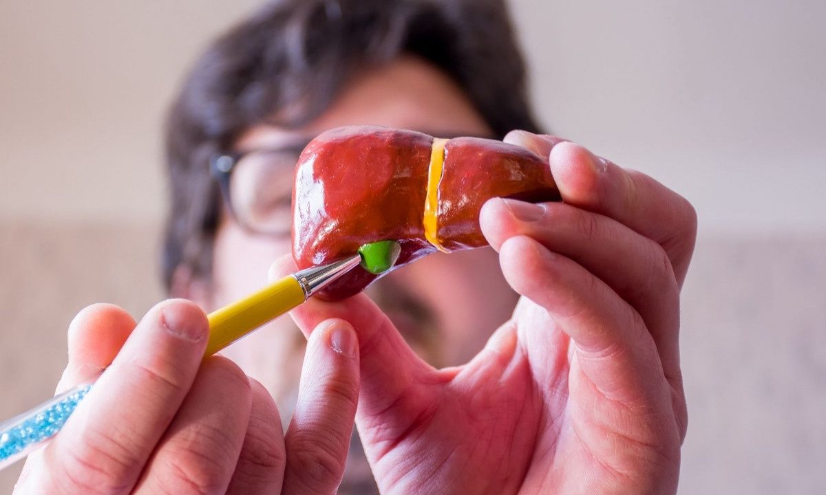 Πολύποδες χοληδόχου κύστης: Παράγοντες κινδύνου και συμπτώματα