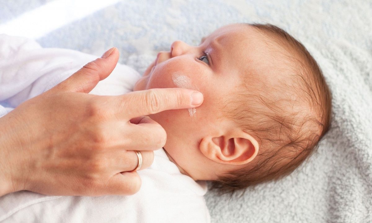 Βρεφικό έκζεμα: Τι δείχνει για τον κίνδυνο μελλοντικών αλλεργιών