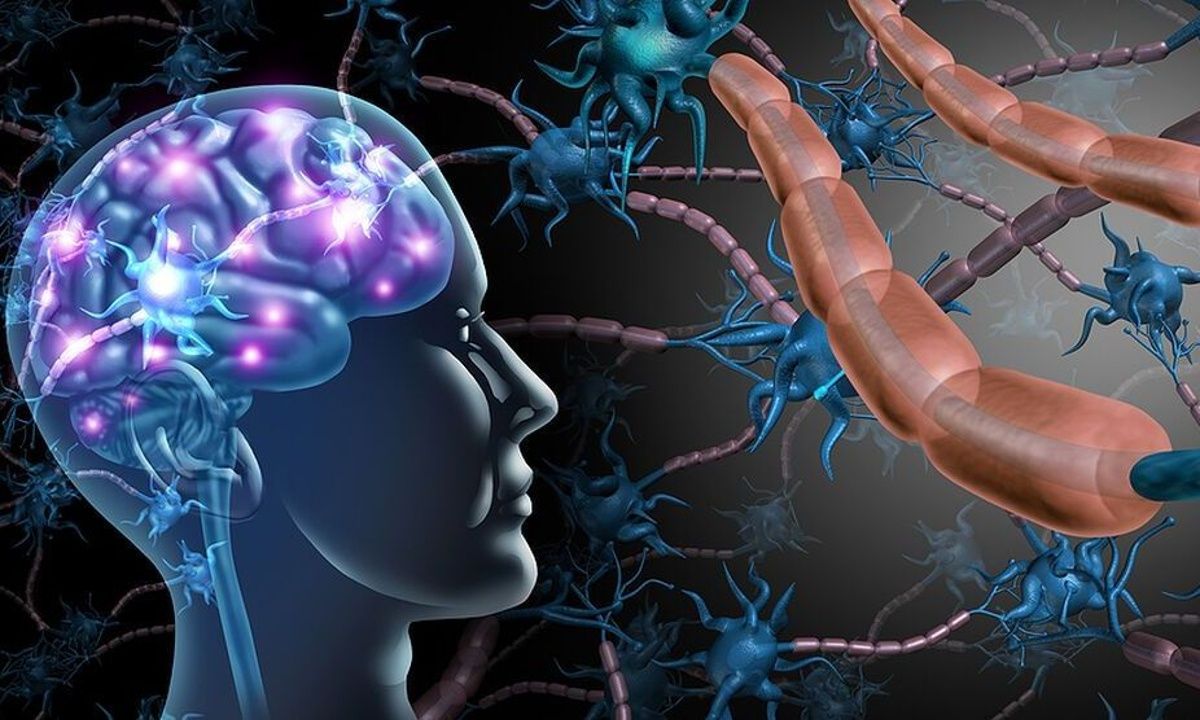 Πολλαπλή σκλήρυνση: Το γονίδιο που συνδέεται με τη σοβαρότητά της