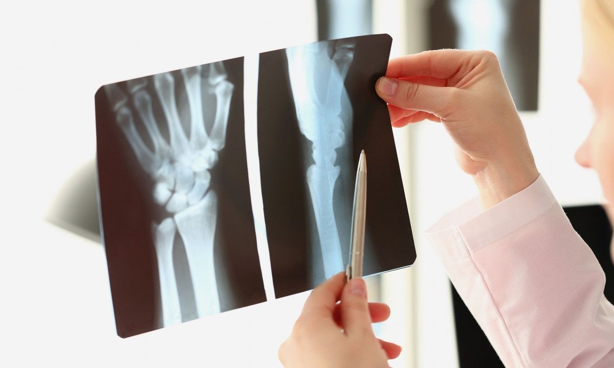 Αρθρίτιδα χεριών: Τι είναι καλύτερο για την αντιμετώπιση του πόνου