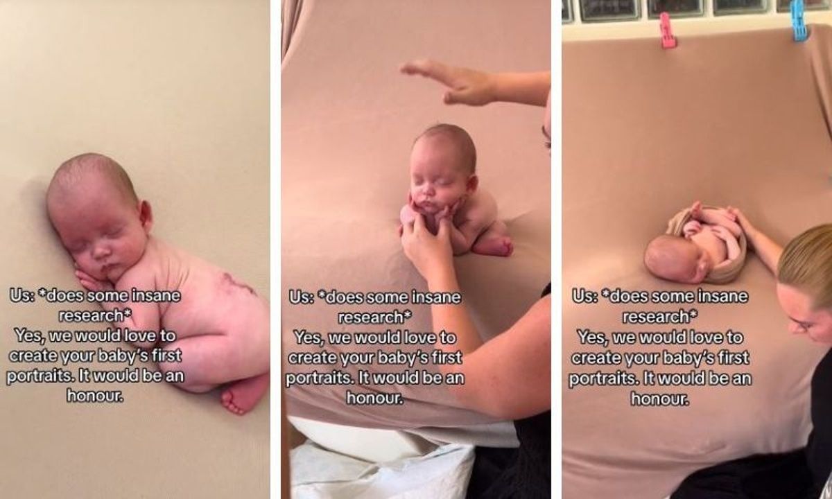 Νεογέννητο με δισχιδής ράχη τράβηξε όλα τα βλέμματα