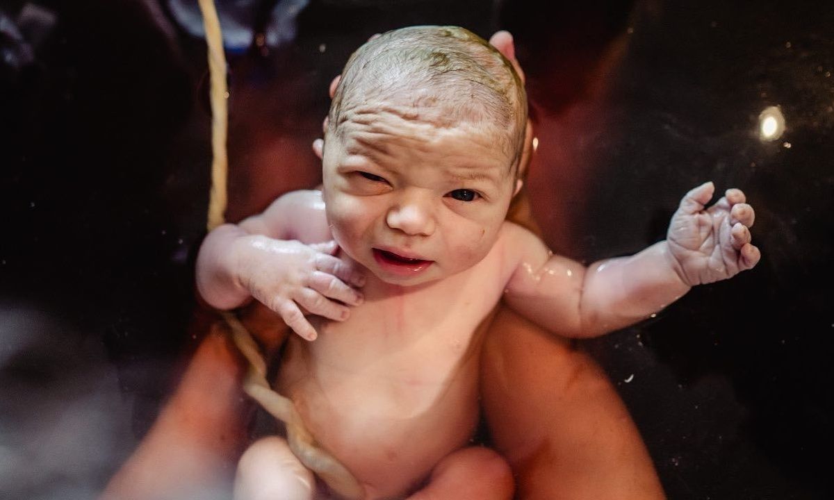 Τα πρώτα λεπτά μετά τη γέννα - Φωτογραφικό άλμπουμ