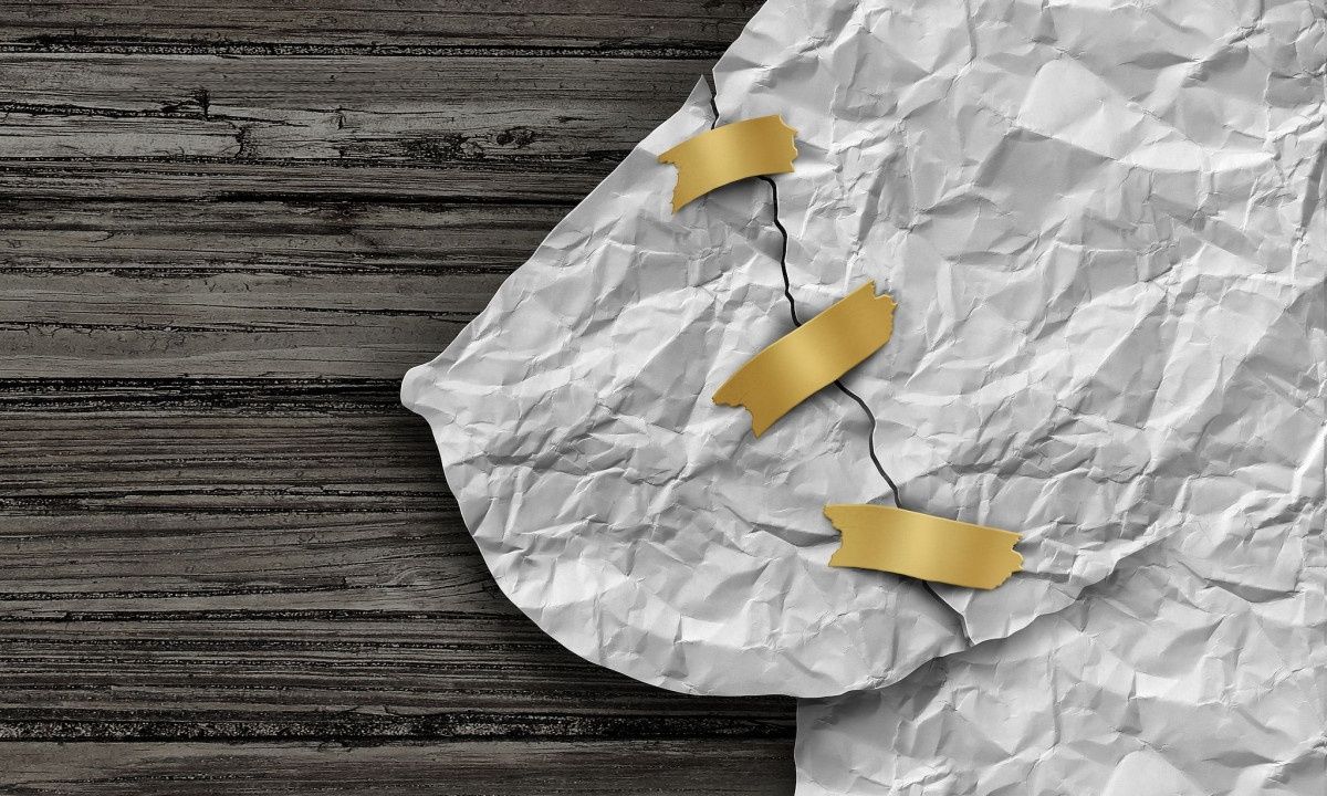 Προληπτική μαστεκτομή: Πόσο μειώνει τον κίνδυνο θανάτου