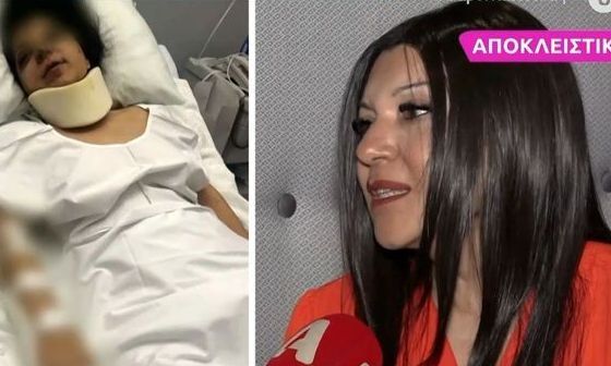 Συγκλονίζει η Ελένη Χαραμή για το σοβαρό τροχαίο: «Χτύπησα στον νωτιαίο μυελό και παρέλυσα»