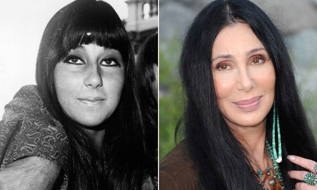 Σερ: Βγήκαν στη «φόρα» οι αισθητικές επεμβάσεις που έχει κάνει η 78χρονη σταρ - Και είναι πολλές!