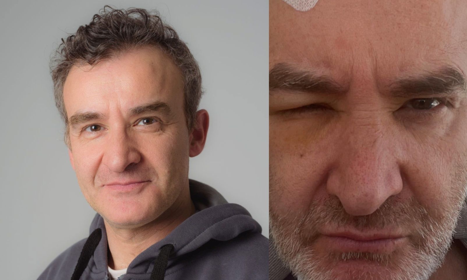 Νίκος Ορφανός: «Αγώνας μέχρι τέλους» - Καθηλώνει για τη σοβαρή περιπέτεια της υγείας του