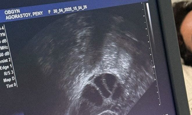 Ανακοίνωσε ανήμερα της Γιορτής της Μητέρας ότι έκανε κρυοσυντήρηση ωαρίων!