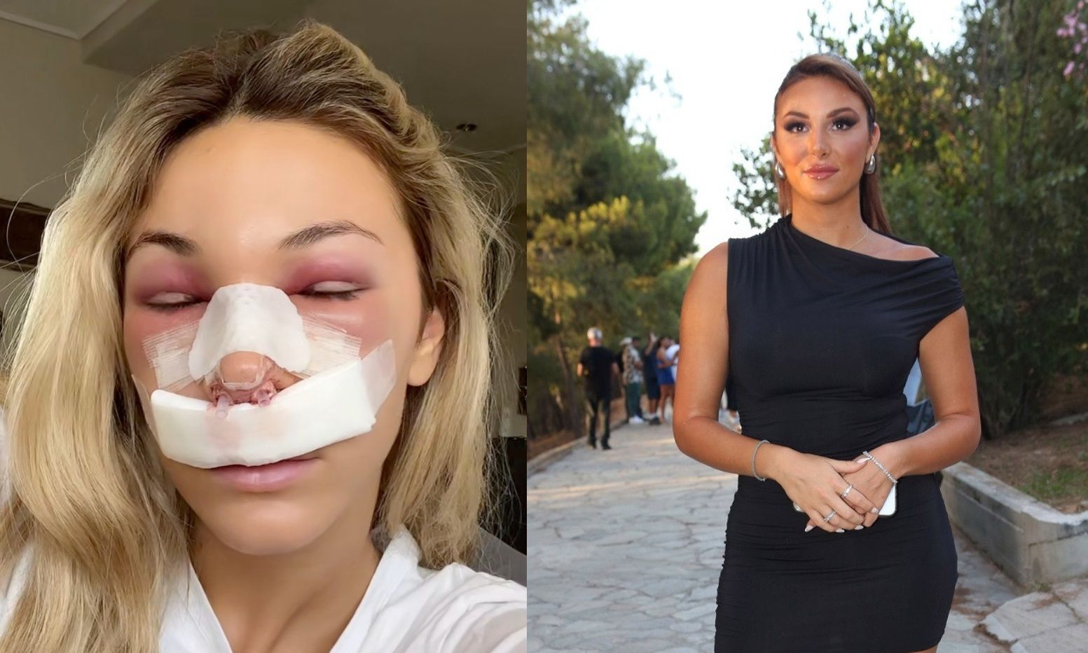 Χρύσα Χατζηγεωργίου: Χαμός στο TikTok με την πλαστική στη μύτη της–«Εσύ είσαι ο κανένας που θα...»