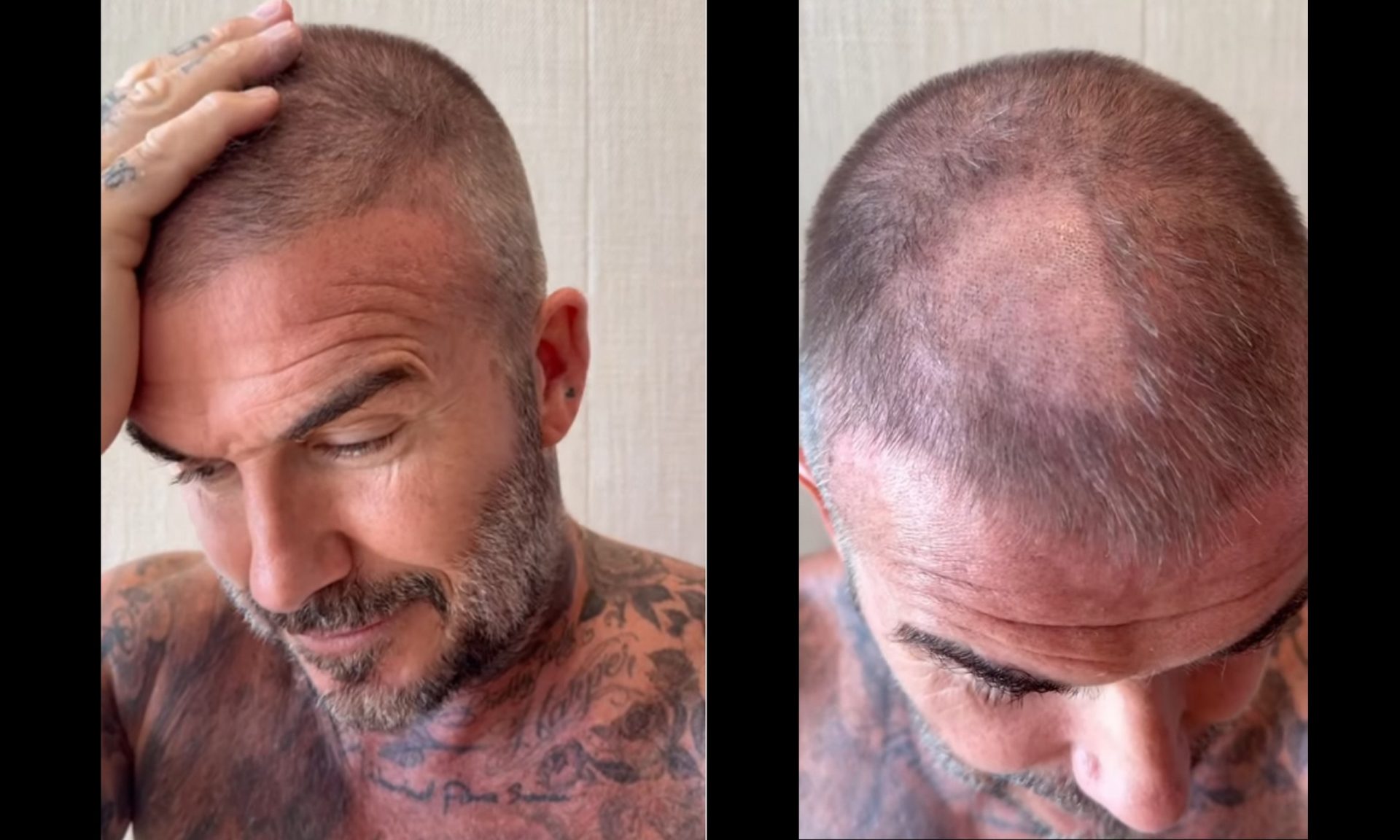 Απολαυστικό: Ο Μπέκαμ είχε ατύχημα όταν προσπάθησε να κουρευτεί μόνος του & η Βικτόρια τον τρολάρει!