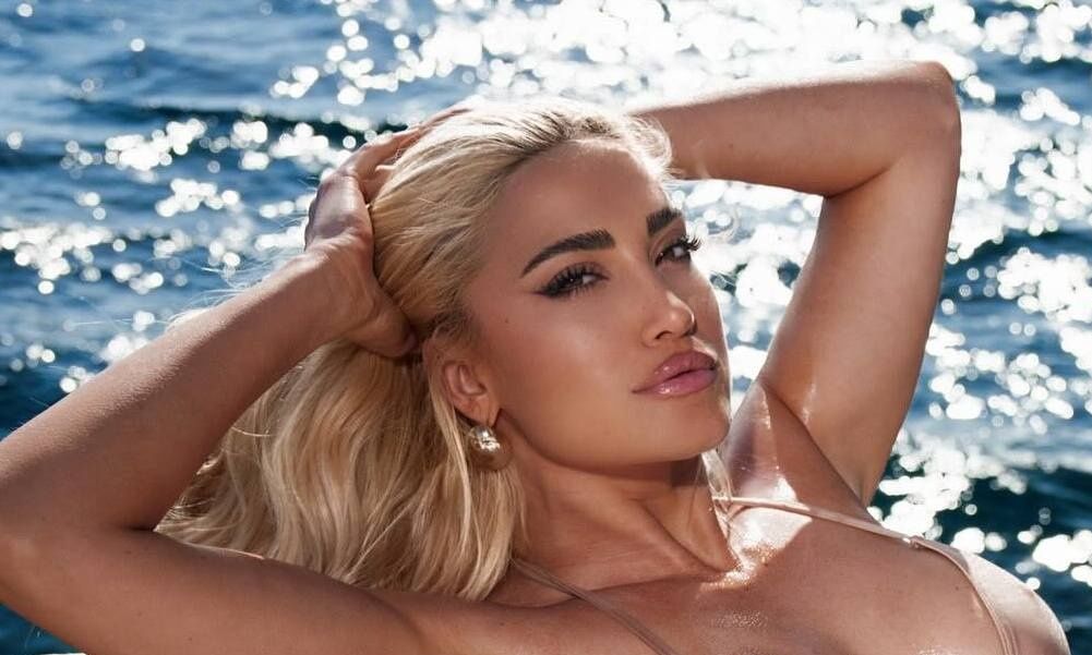 Τούνη: Το βίντεο από το νοσοκομείο, το μελανιασμένο πόδι & η διάγνωση των γιατρών μετά το ατύχημα