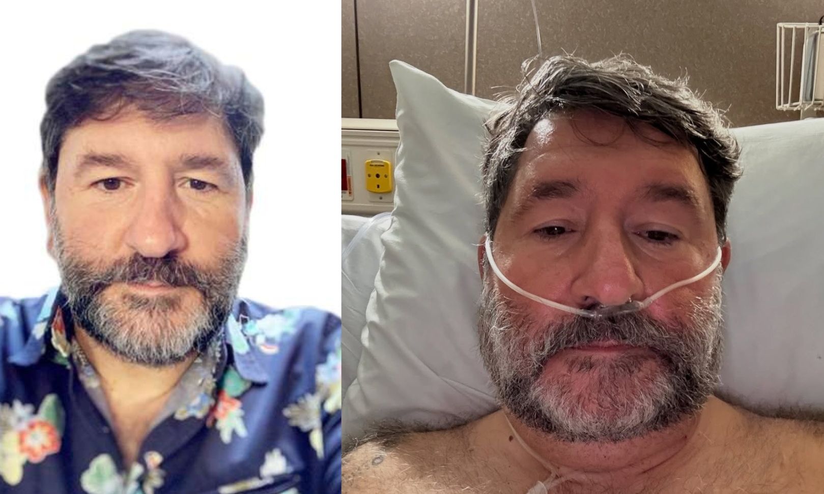 Συγκλονίζει ο Γιάννης Μπουροδήμος από το Masterchef - H επέμβαση αφαίρεσης όγκου & το μήνυμα