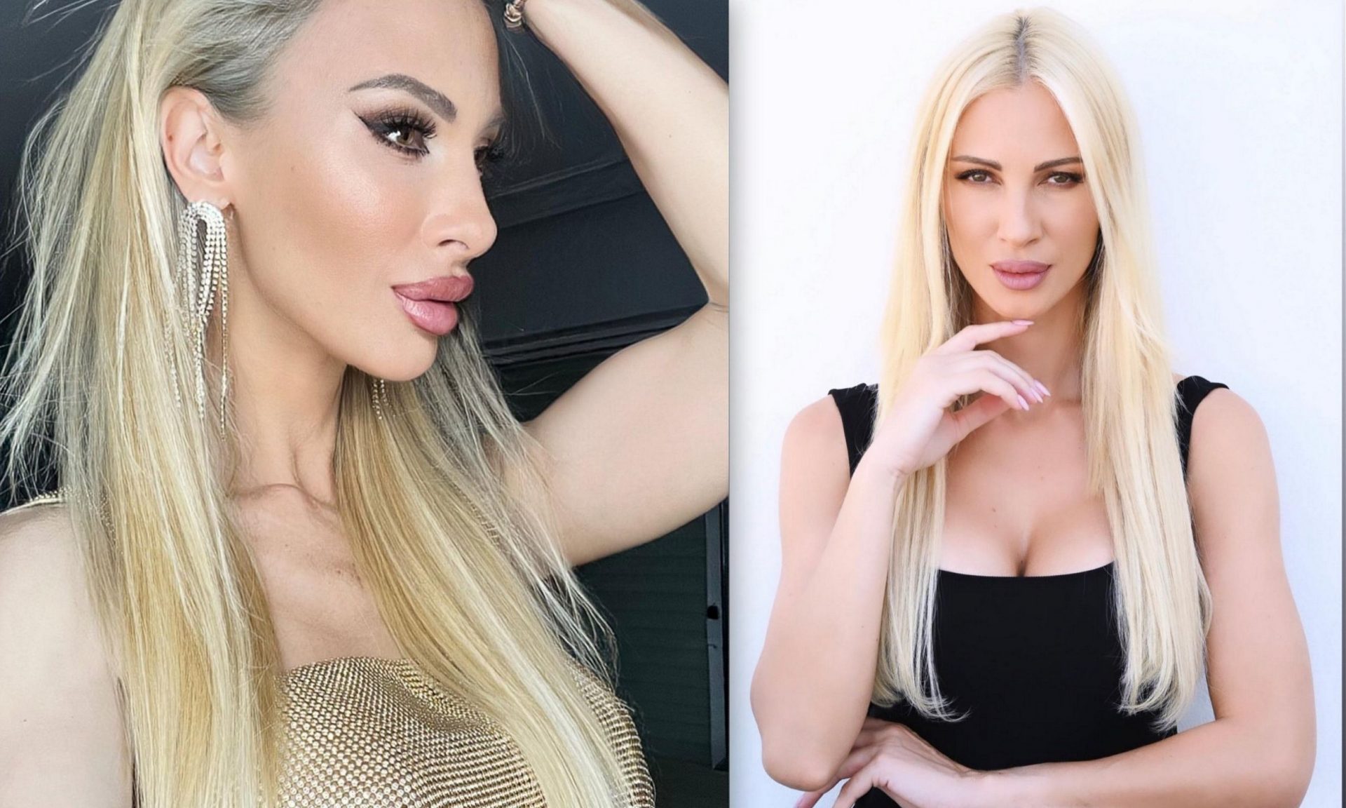 Κουκίου: Ο μικρότερος σύντροφος & οι πλαστικές-Γιατί πρέπει να απολογηθώ για το τι κάνω στο πρόσωπο;