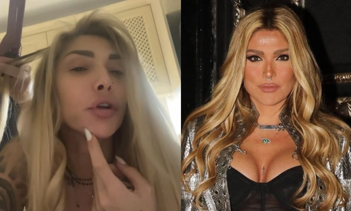 Αγγελική Ηλιάδη: Η μελανιά στο πρόσωπο, ο λόγος που την απέκτησε και η απάντηση στα αρνητικά σχόλια