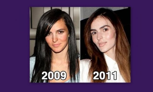 ΣΟΚ: 17χρονη άλλαξε το πρόσωπό της για να γίνει μοντέλο