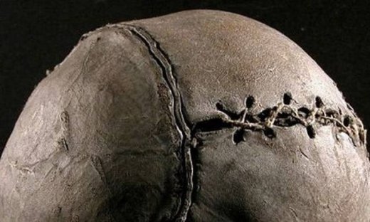 Ανακάλυψη των Σκοτσέζων το ποδόσφαιρο;