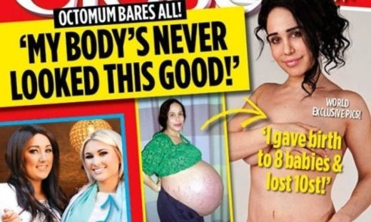 Κι όμως έχασε 63 κιλά… (Αποκλειστικά στο Tsimtsilicious)