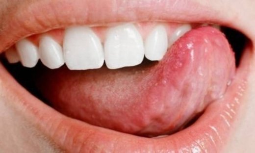 Γιατρέ τρίζω τα δόντια μου