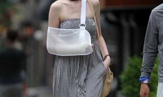 Ποια έβαλε το χέρι στο γύψο;