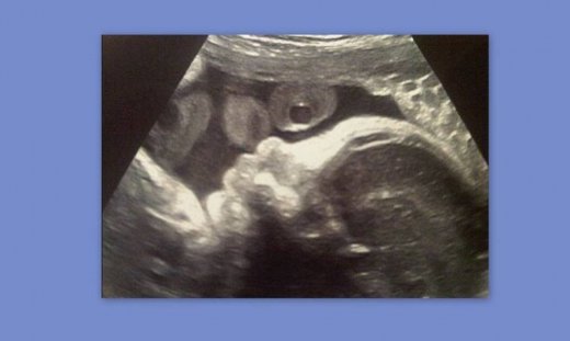 Η πρώτη φωτογραφία του μωρού τους!