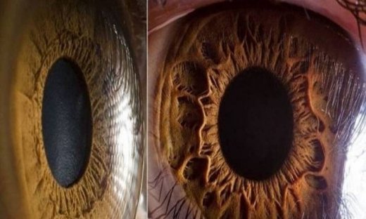 Εντυπωσιακές φωτογραφίες: Το ανθρώπινο μάτι όπως δεν το έχετε δει