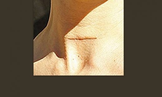 Διάσημη δείχνει την τομή της από εγχείρηση αφαίρεσης καρκίνου στο θυρεοειδή!